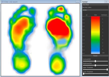 SPI Tactilus 足底压力分布测量系统（平板式）