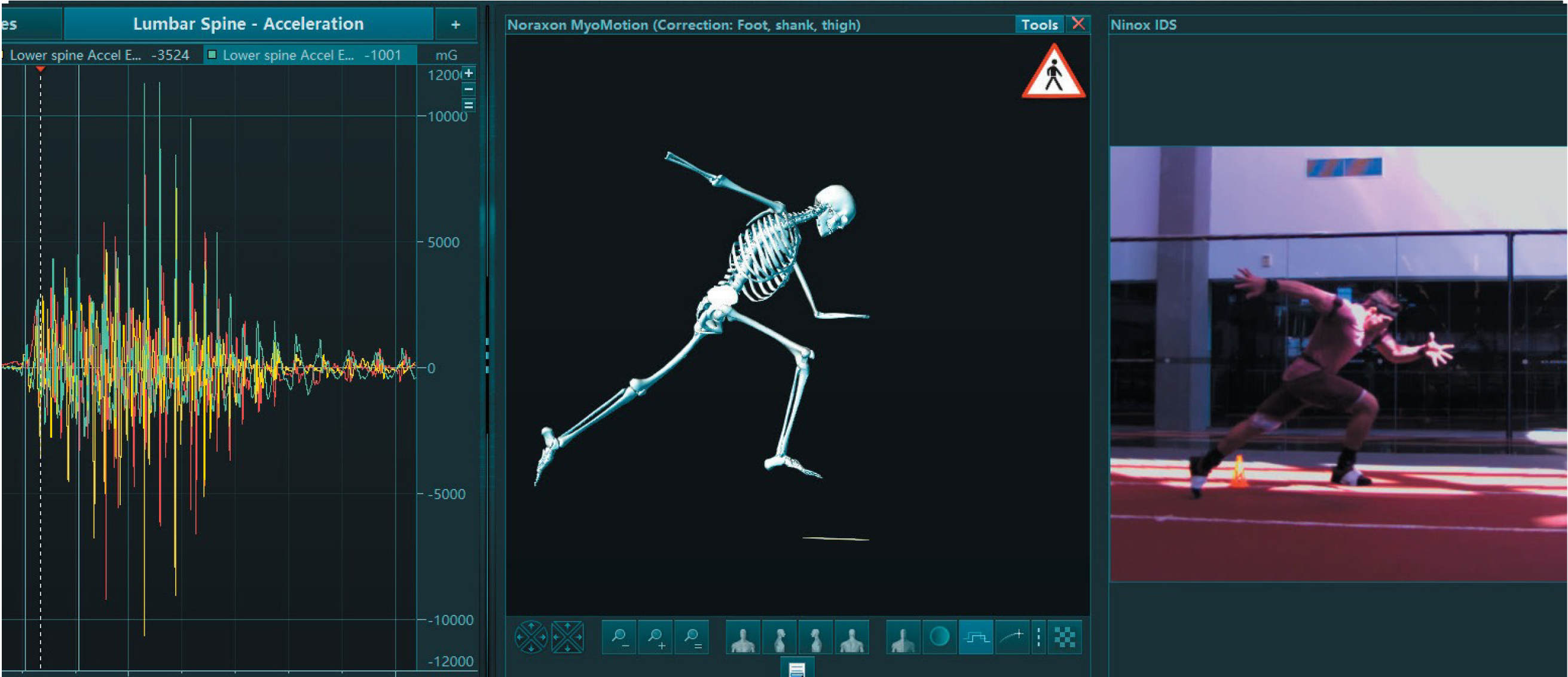 MyoMotion 3D运动捕捉系统