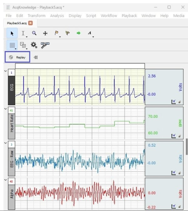 BIOPAC-AcqKnowledge 5 data acquisition and analysis software