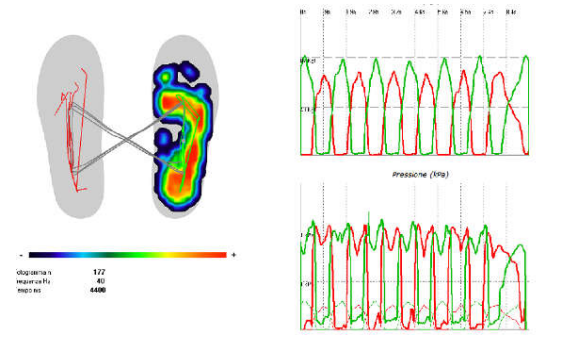 Sensor Medica 足底压力分析系统