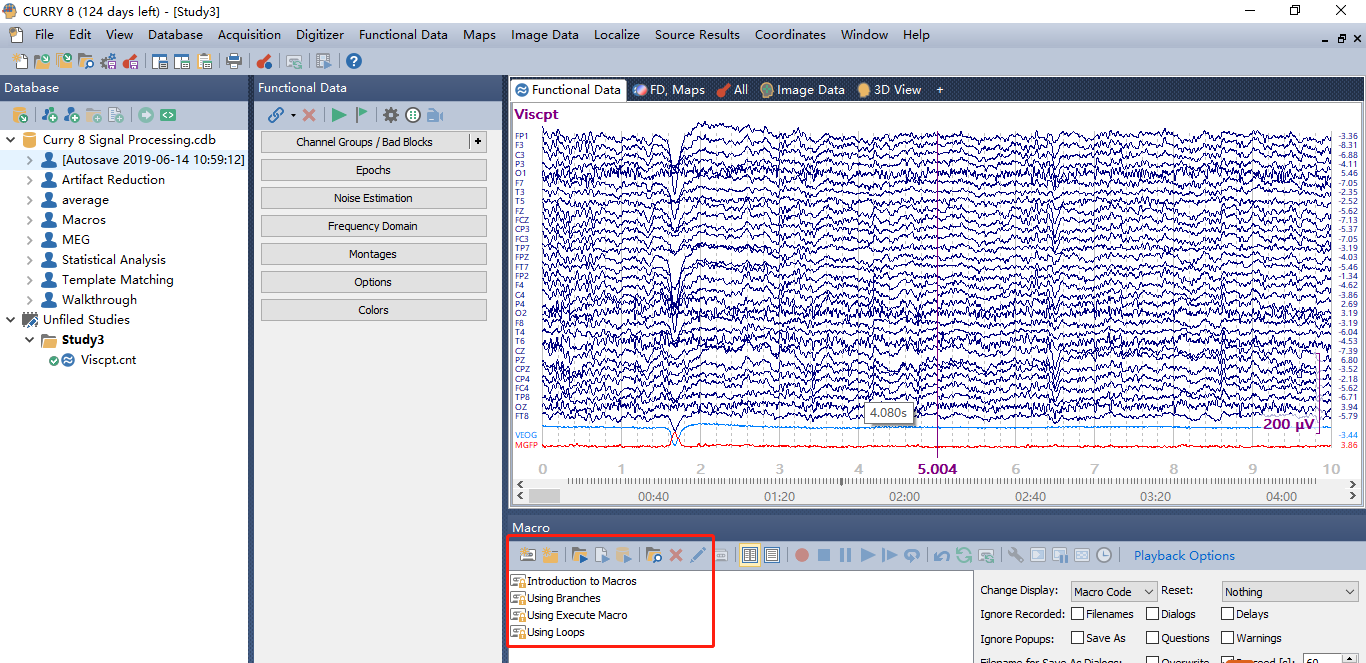 Neuroscan脑电 Neuroscan脑电