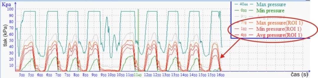 行走周期中的动态压力曲线