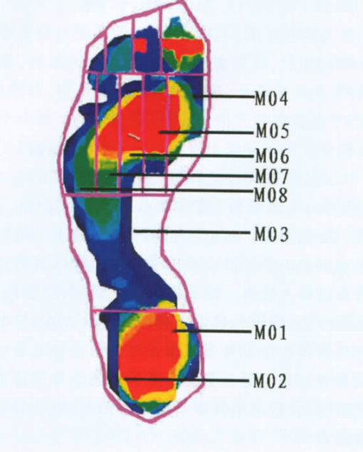 扁平足与正常足举重运动员足底压力分布对照研究 扁平足与正常足举重运动员足底压力分布对照研究