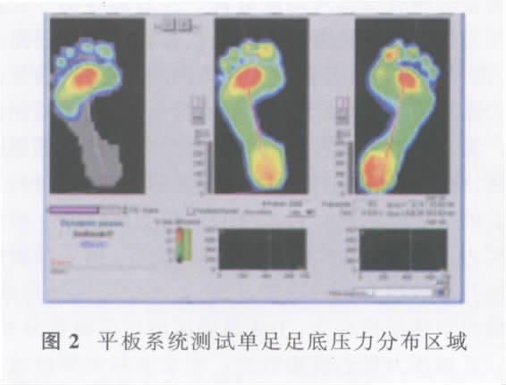 足踝部反复损伤青少年足球运动员 FootScan 足底压力分析 足踝部反复损伤青少年足球运动员 FootScan 足底压力分析