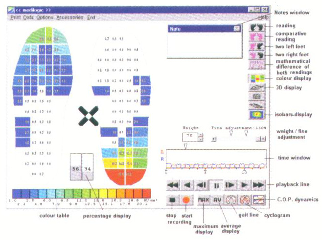 基于F-Scan三维动态足底压力分析系统的动静态足底压力分析 基于F-Scan三维动态足底压力分析系统的动静态足底压力分析