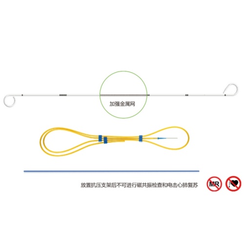 优泰输尿管支架(内置金属)