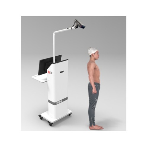 SIGMA-2 脊柱侧弯三维扫描仪