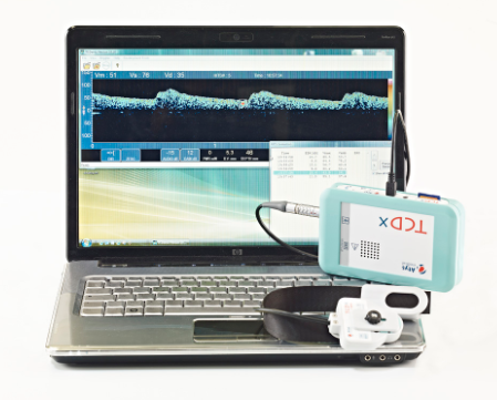 美科便携式移动经颅多普勒