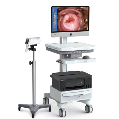 同人电子阴道镜成像系统CH1000