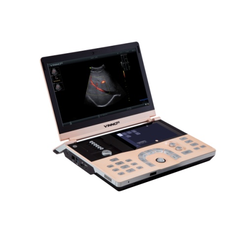 飞依诺便携式数字化彩色超声诊断仪VINNO 10
