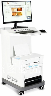 冠邦数码电子阴道镜 GB-S2000