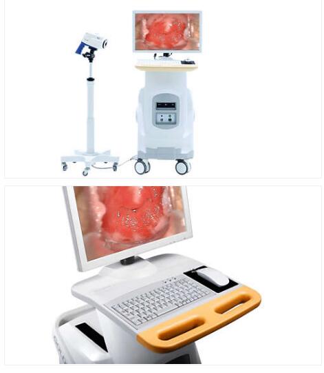 飞利浦SLC-2000B电子阴道镜数字成像系统