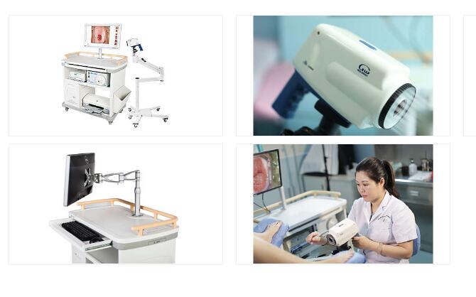 飞利浦SLC-3000 电子阴道镜数字成像系统