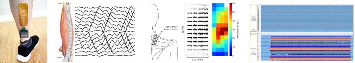 OT便携式高密度矩阵肌电测试系统